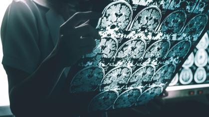 a doctor holding a brain scan image